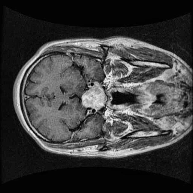 Brain MRI sample 1